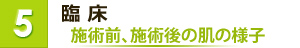 臨床