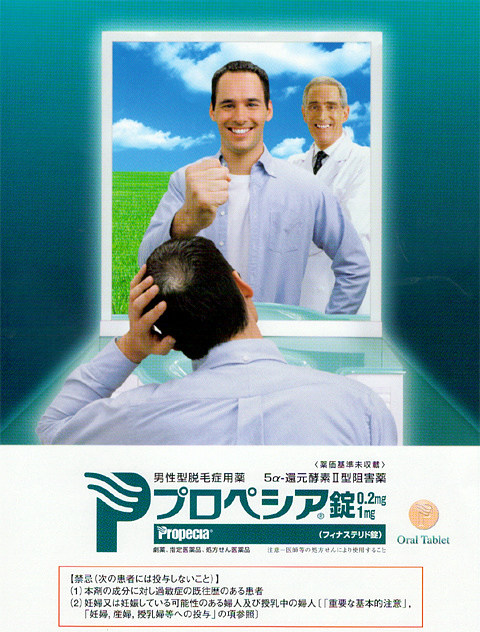 プロペシア